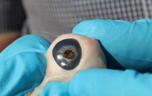 用望远镜看太阳太可怕:眼球直接被烧穿